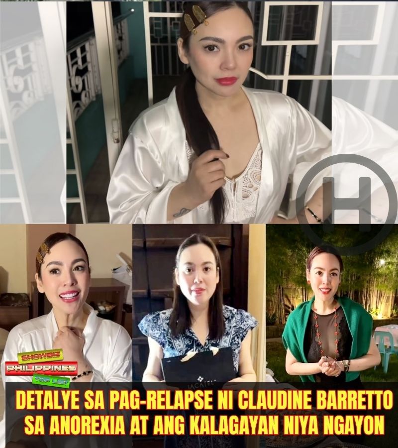 Claudine Barretto at ang Pag‑Relapse sa Anorexia: Ang Laban sa Mental Health at Pressures ng Showbiz (nh)