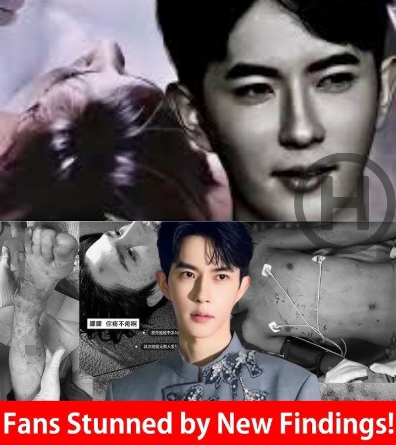 News Alert: Today’s Shocking Discovery About Yu Menglong’s Body Before His d34th Is Truly Horrifying