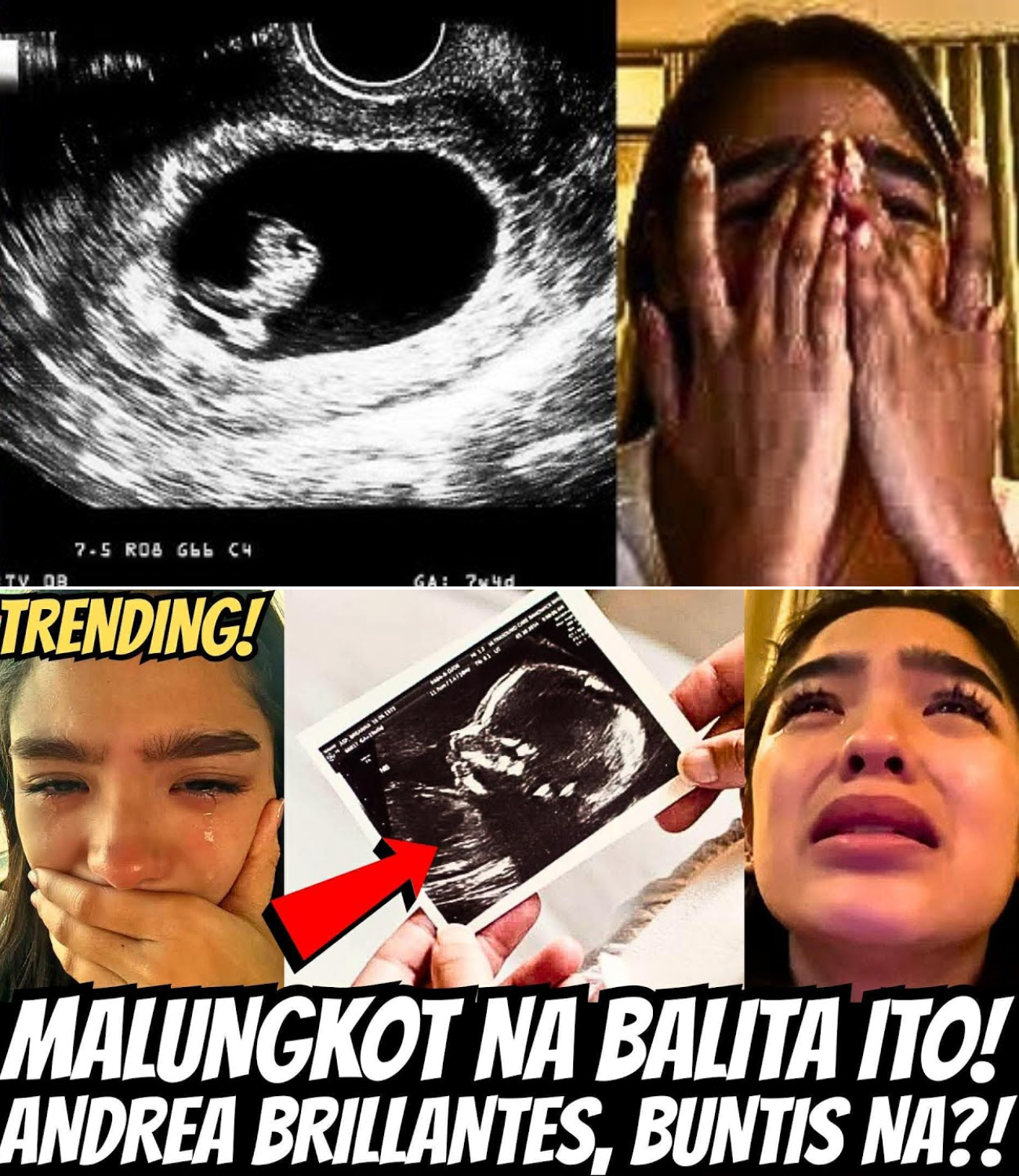 Andrea Brillantes, Nilinaw ang Isyu ng Pagbubuntis: Ang Katotohanan sa Likod ng Viral na Haka-haka