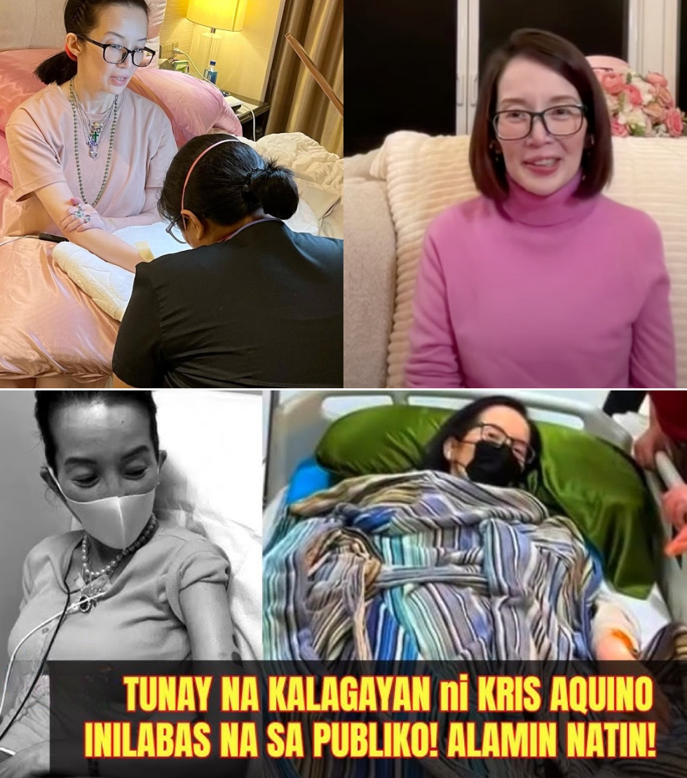 Reyna ng Media Noon Mandirigma ng Buhay Ngayon: Ang Nakakanginig na Katotohanan sa Likod ng Rare na Sakit at Matinding Pakikipaglaban ni Kris Aquino